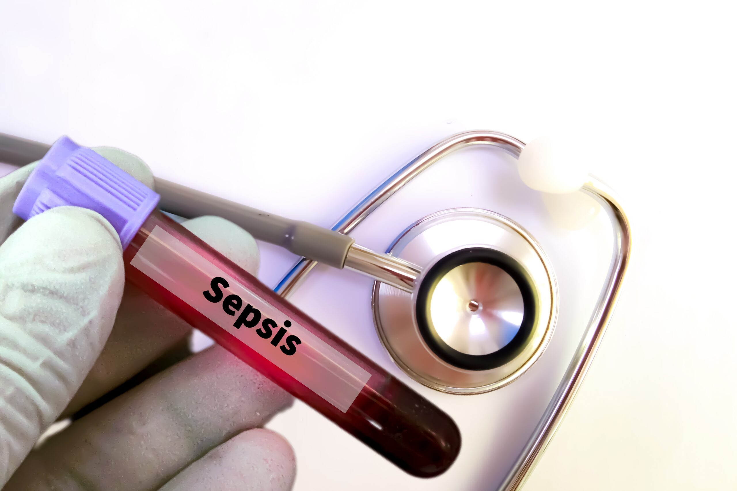 Sepsis after surgery symptoms and warning signs linked to possible medical malpractice.